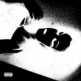 Боль в глазах