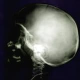 Symptoms of Our Trading System