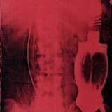 Wounded – But Welding the Flesh of a Clown With a Lead Penis