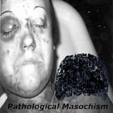 Milking The Prostate Of A 25 Year Old Man With A Flacid D