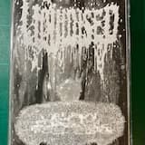 Ectopias Testiculares