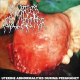 Uterine Abnormalities During Pregnancy