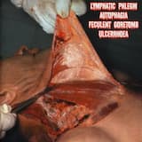 Intro: Gruesomely Induecd to Regurgitate