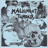 Situs Viscerum Inversus Totalis