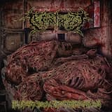 Stone(d) Man Syndrome