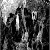 Covered In Her Blood