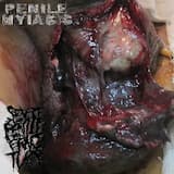 Untitled Gangrenous Erections