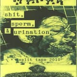 An Unfortunate Failure To Repair The Recto-ano-vaginal Canal Resulting In An Undesired Dilatation Of The Entire Outer Anal Structural Wall Lining Making For Painful Sensations In The Continued Acts Of Rectal Intercourse And Sexual Practices