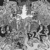 Overwhelmed by the Infect and Deteriorated Putral Sinus as a Result of Bodily Forged Decay