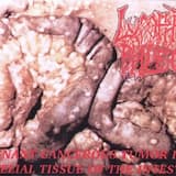 Manifestation of Purulent Cystical Bacillosis in the Internal Ligaments of the Bile Visicle.