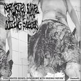 Bleeding Out Chunks Of What Used To Be Your Sexual Organs