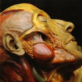 Compulsive Concupiscentia of Pathologist