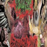 Surgical Malpractice