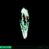 NEW KID ON THE BLOCK