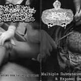 Multiple Subcutaneous Cuts On Mangled And Exposed Ostosibrotma