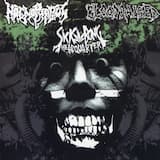 Gimme Back My Eyeballs