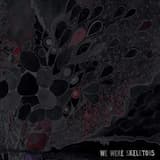 Exposure to Heavy Metal Causes Whatever