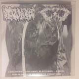 Carcinomas In Sutu (Cis) (An Early Form Of Cancer That Is Defined By The Absence Of Invasion Of Tumor Cells Into The Surrounding Tissue, Usually Before Penetration Through The Basement Membrane)