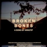 Broken Bones