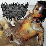 Spontaneous Rectal Combustion Epidemic