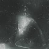 To Love in a Negative Space