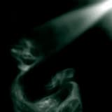 The Black Balloon & The Armadillo